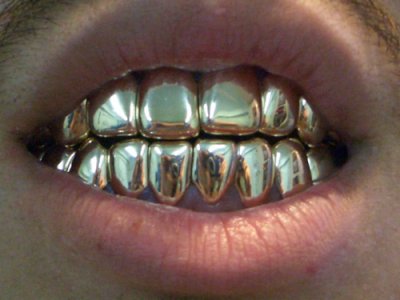 GOLD-TEETH-1.jpg GOLD-TEETH-1.jpg