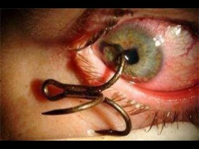 eye-hook1.jpg