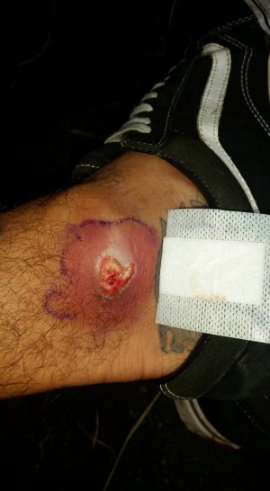 ouch.jpg