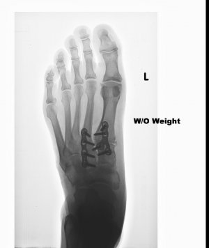 Left fppt 6-6-16.jpg